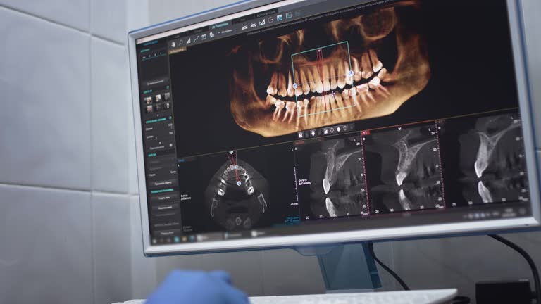 Full Mouth Reconstruction in Muncy, PA